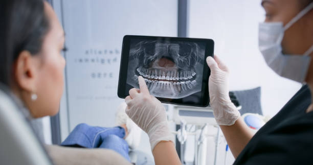 Licensed Tooth Extraction service in Queen City, TX - Smile Center Dentistry